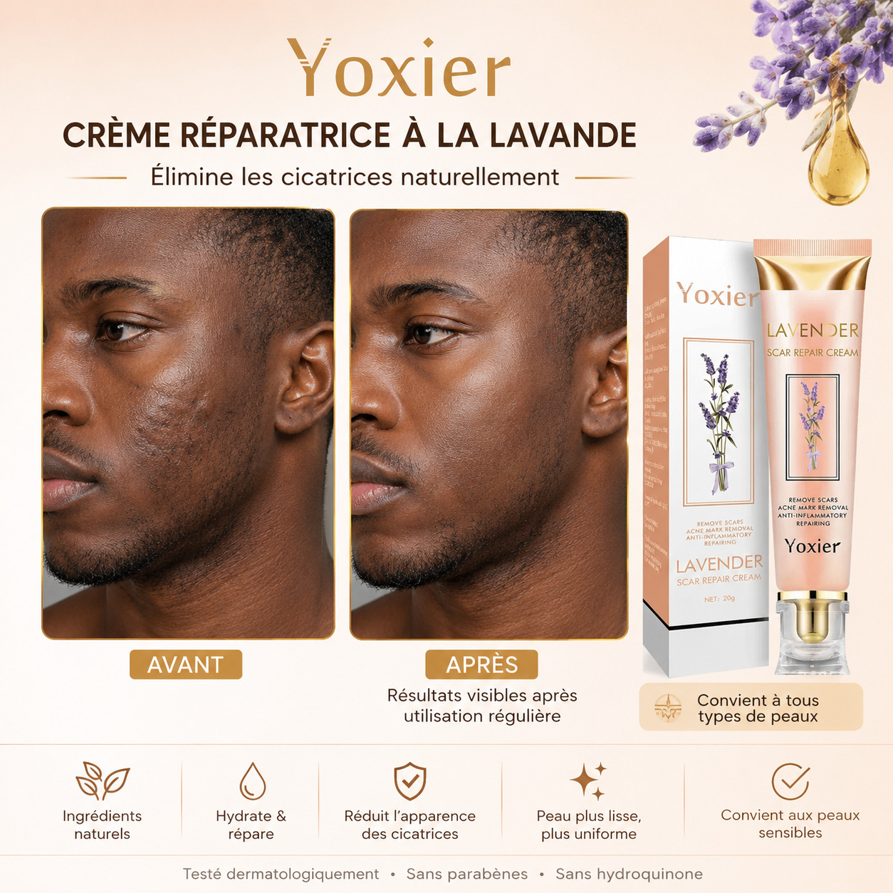 Crème Yoxier